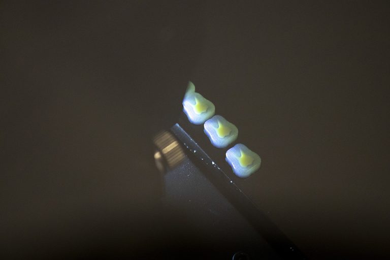 3D tlač v zubnom lekárstve